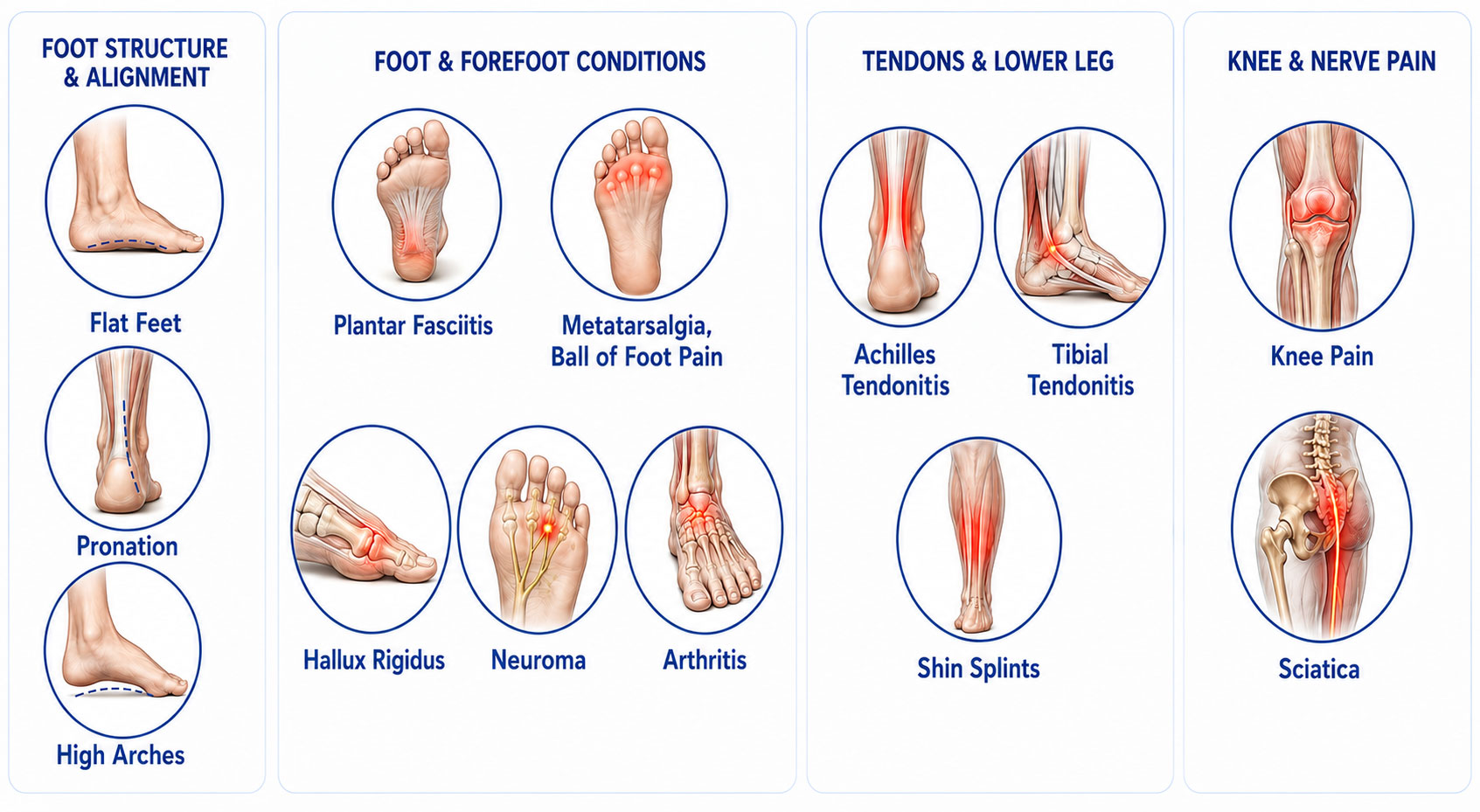 Common-Foot-Problems-Orthotics-Can-Help | The FootLab Custom Orthotics | St Paul Minneapolis MN Common Foot Problems Orthotics Can Help
